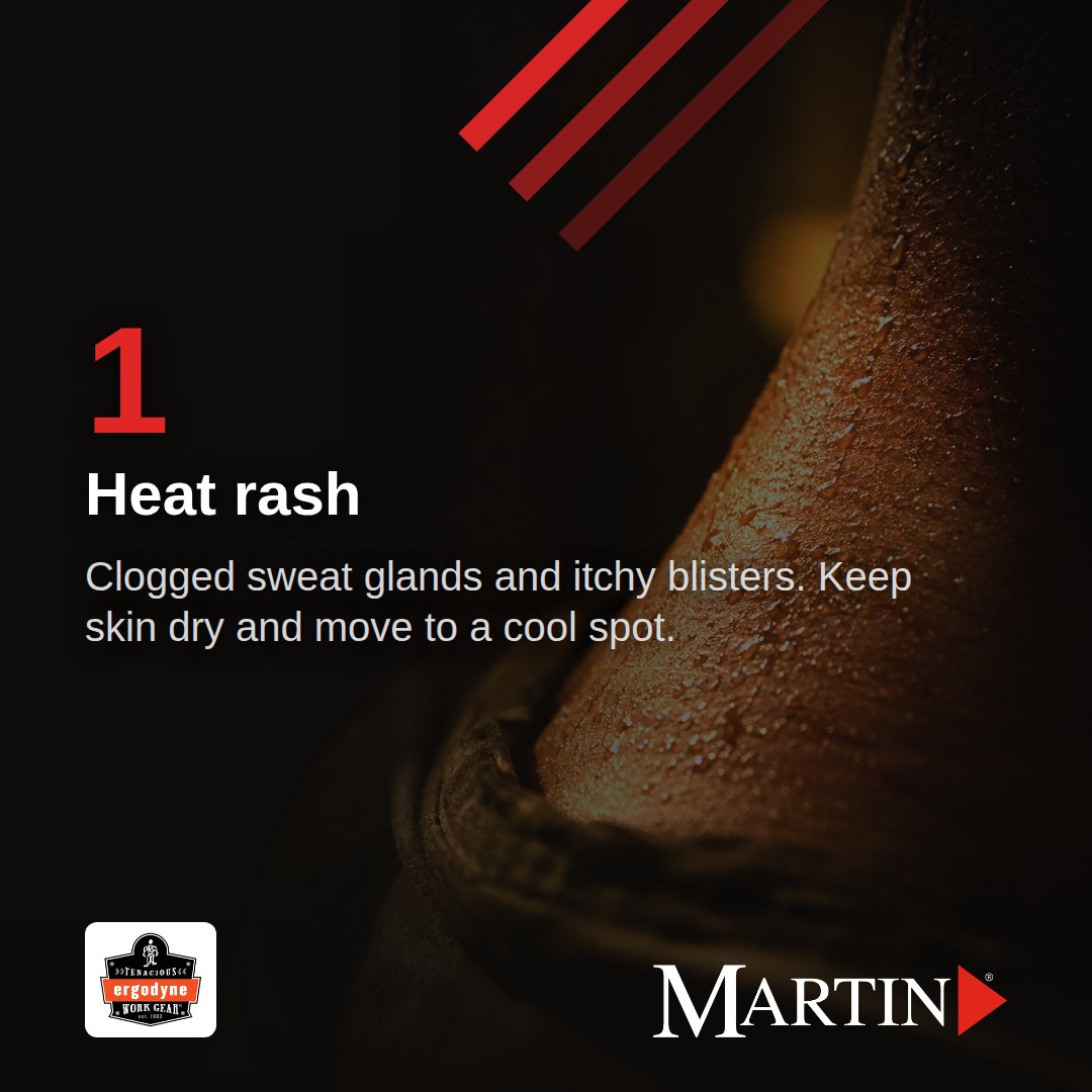 Carousel panel 2: heat rash